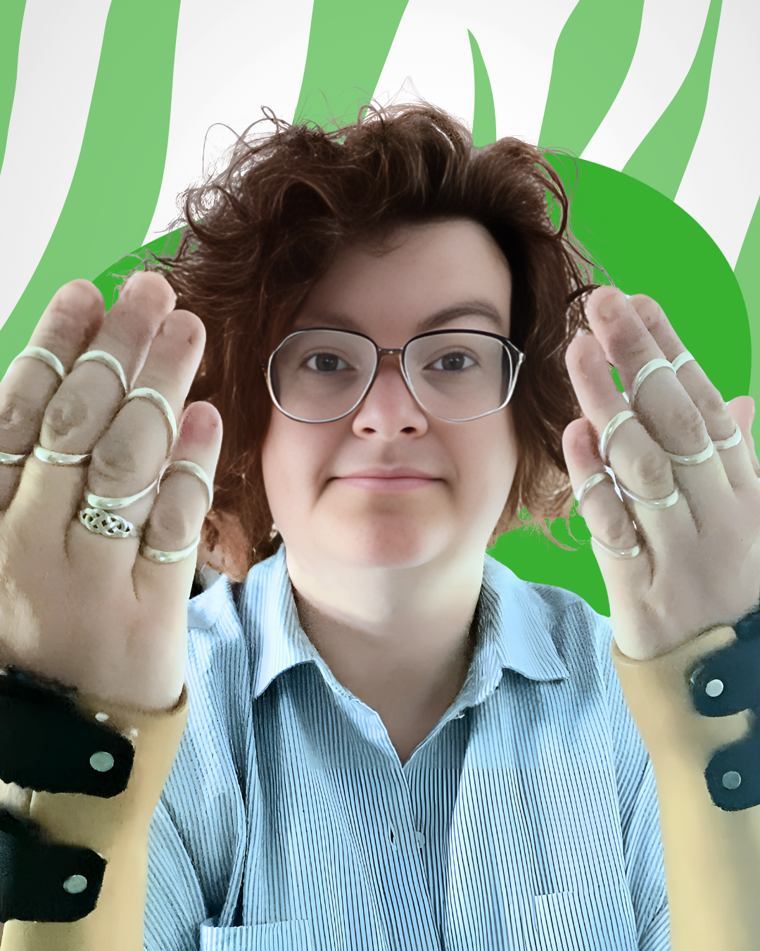 🦓 Splint Hero Maartje zum Monat der Hypermobilität